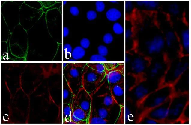 Immunocytochemistry/ Immunofluorescence - Anti-ICAM1 antibody [RP23040065] (AB307993)