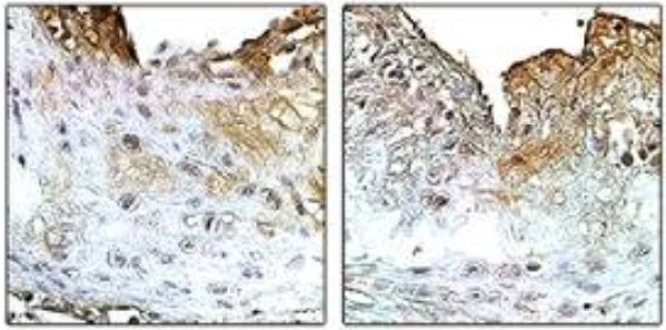 Immunohistochemistry (Formalin/PFA-fixed paraffin-embedded sections) - Anti-ICAM1 antibody [YN1/1.7.4] (AB119871)
