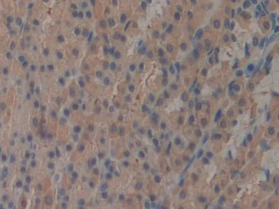 Immunohistochemistry (Formalin/PFA-fixed paraffin-embedded sections) - Anti-ICAM2 antibody (AB231097)