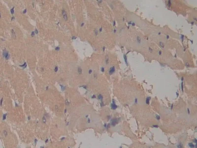 Immunohistochemistry (Formalin/PFA-fixed paraffin-embedded sections) - Anti-ICAM2 antibody (AB231097)