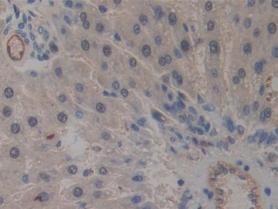 Immunohistochemistry (Formalin/PFA-fixed paraffin-embedded sections) - Anti-ICAM2 antibody (AB231097), expandable thumbnail