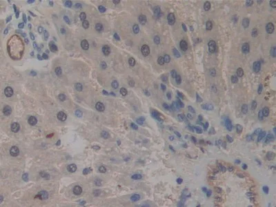 Immunohistochemistry (Formalin/PFA-fixed paraffin-embedded sections) - Anti-ICAM2 antibody (AB231097)