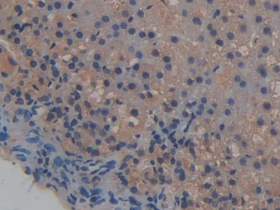 Immunohistochemistry (Formalin/PFA-fixed paraffin-embedded sections) - Anti-ICAM2 antibody (AB231097)