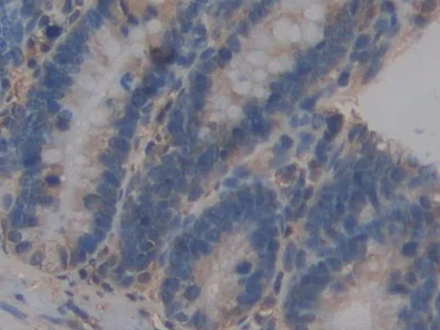 Immunohistochemistry (Formalin/PFA-fixed paraffin-embedded sections) - Anti-ICAM2 antibody (AB231097)