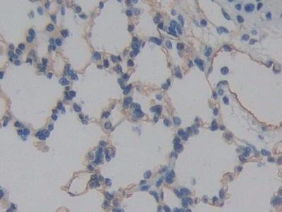 Immunohistochemistry (Formalin/PFA-fixed paraffin-embedded sections) - Anti-ICAM2 antibody (AB231097), expandable thumbnail