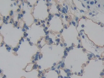 Immunohistochemistry (Formalin/PFA-fixed paraffin-embedded sections) - Anti-ICAM2 antibody (AB231097)