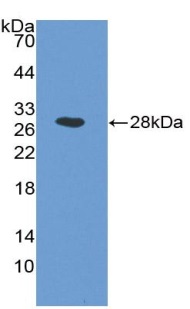 Western blot - Anti-ICAM2 antibody (ab231097), expandable thumbnail