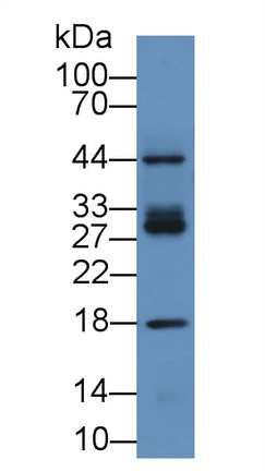 Western blot - Anti-ICAM2 antibody (AB231564)