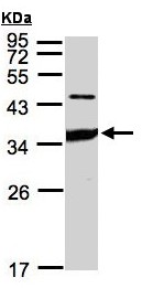 Western blot - Anti-ICAM2 antibody (AB96443), expandable thumbnail