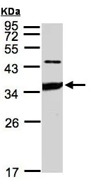 Western blot - Anti-ICAM2 antibody (AB96443)