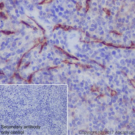 Immunohistochemistry (Formalin/PFA-fixed paraffin-embedded sections) - Anti-ICAM2 antibody [EPR18231-183] (AB189463)