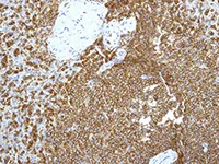 Immunohistochemistry (Formalin/PFA-fixed paraffin-embedded sections) - Anti-ICAM3 antibody [EPR3994-123] - BSA and Azide free (AB247851)