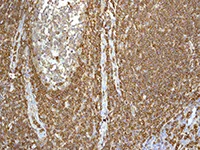 Immunohistochemistry (Formalin/PFA-fixed paraffin-embedded sections) - Anti-ICAM3 antibody [EPR3994-123] - BSA and Azide free (AB247851)