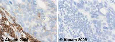 Immunohistochemistry (Formalin/PFA-fixed paraffin-embedded sections) - Anti-ICAM3 antibody [ICAM3.1] (AB10804)