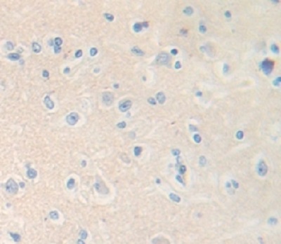 Immunohistochemistry (Formalin/PFA-fixed paraffin-embedded sections) - Anti-ICAM5 antibody (AB232785), expandable thumbnail