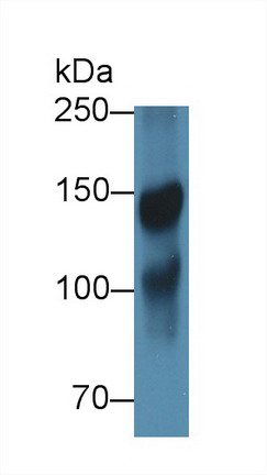 Western blot - Anti-ICAM5 antibody (AB232785), expandable thumbnail