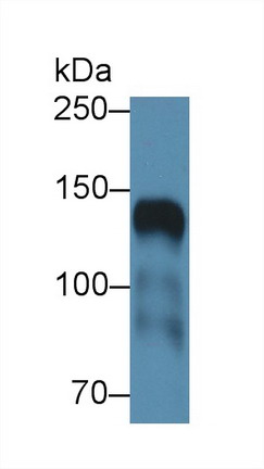 Western blot - Anti-ICAM5 antibody (AB232785), expandable thumbnail