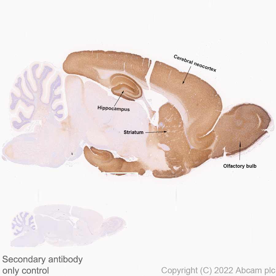 Immunohistochemistry - Anti-ICAM5 antibody [EPR25850-86] (AB302899), expandable thumbnail