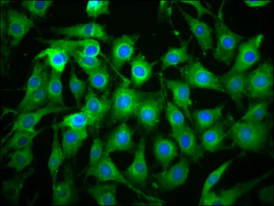 Immunocytochemistry/ Immunofluorescence - Anti-ICB1 antibody (AB236975)