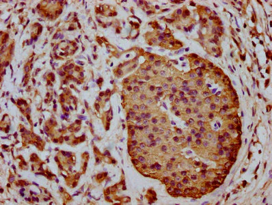 Immunohistochemistry (Formalin/PFA-fixed paraffin-embedded sections) - Anti-ICB1 antibody (AB236975)