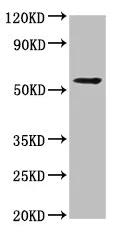 Western blot - Anti-ICB1 antibody (AB236975)