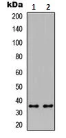 Western blot - Anti-ICER antibody (AB230543)
