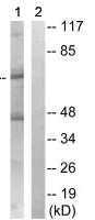 Western blot - Anti-ICK antibody (AB196964)