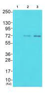 Western blot - Anti-ICK antibody (AB196964)