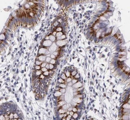 Immunohistochemistry (Formalin/PFA-fixed paraffin-embedded sections) - Anti-ICK antibody (AB224220)
