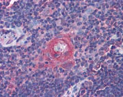 Immunohistochemistry (Formalin/PFA-fixed paraffin-embedded sections) - Anti-ICOS antibody (AB111247)