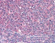 Immunohistochemistry (Formalin/PFA-fixed paraffin-embedded sections) - Anti-ICOS antibody (AB111247)