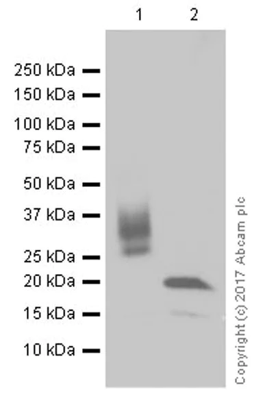 Western blot - Anti-ICOS antibody [EPR20560] (AB224644)
