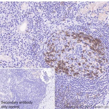 Immunohistochemistry (Formalin/PFA-fixed paraffin-embedded sections) - Anti-ICOS antibody [EPR20560] - BSA and Azide free (AB225577)