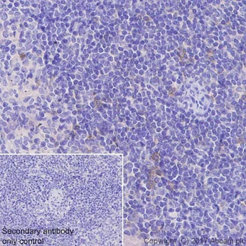 Immunohistochemistry (Formalin/PFA-fixed paraffin-embedded sections) - Anti-ICOS antibody [EPR20560] - BSA and Azide free (AB225577)