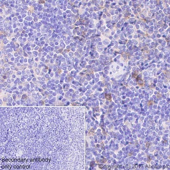 Immunohistochemistry (Formalin/PFA-fixed paraffin-embedded sections) - Anti-ICOS antibody [EPR20560] - BSA and Azide free (AB225577)