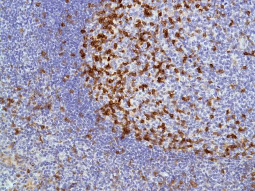 Immunohistochemistry (Formalin/PFA-fixed paraffin-embedded sections) - Anti-ICOS antibody [SP98] (AB105227)