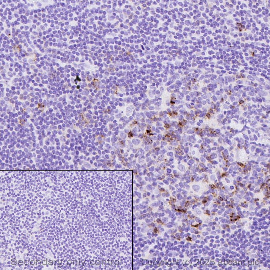 Immunohistochemistry (Formalin/PFA-fixed paraffin-embedded sections) - Anti-ICOS antibody [SP98] (ab105227), expandable thumbnail