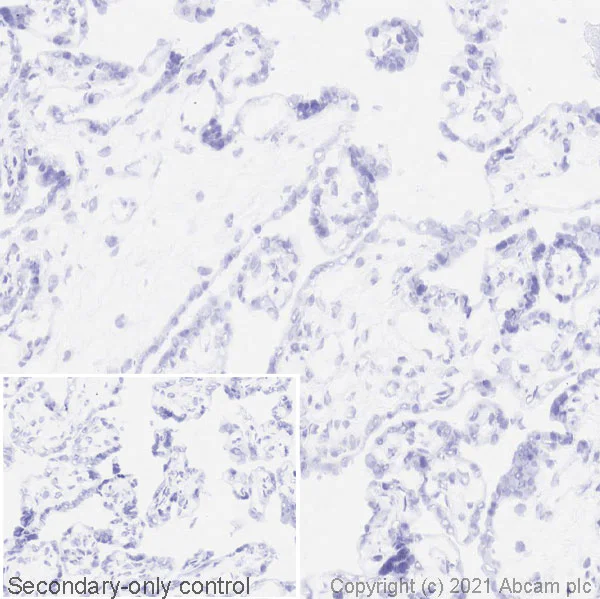 Immunohistochemistry (Frozen sections) - Anti-ICOS antibody [SP98] (AB105227)