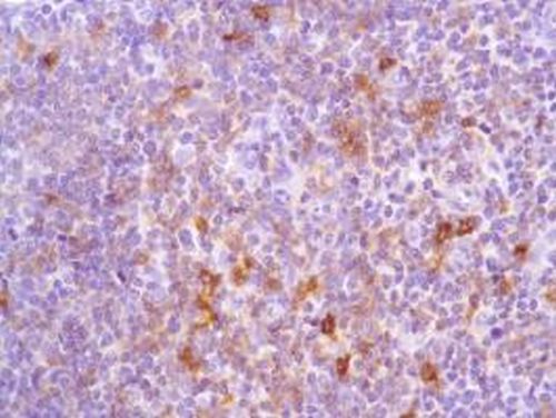 Immunohistochemistry (Formalin/PFA-fixed paraffin-embedded sections) - Anti-ICOS antibody [SP98] - BSA and Azide free (AB236226), expandable thumbnail