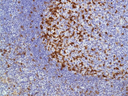 Immunohistochemistry (Formalin/PFA-fixed paraffin-embedded sections) - Anti-ICOS antibody [SP98] - BSA and Azide free (AB236226), expandable thumbnail