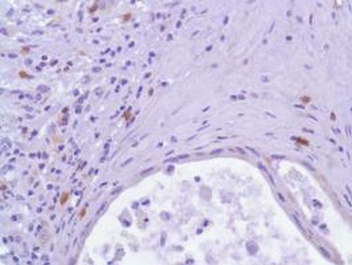 Immunohistochemistry (Formalin/PFA-fixed paraffin-embedded sections) - Anti-ICOS antibody [SP98] - BSA and Azide free (AB236226), expandable thumbnail