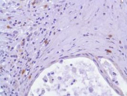 Immunohistochemistry (Formalin/PFA-fixed paraffin-embedded sections) - Anti-ICOS antibody [SP98] - BSA and Azide free (AB236226)