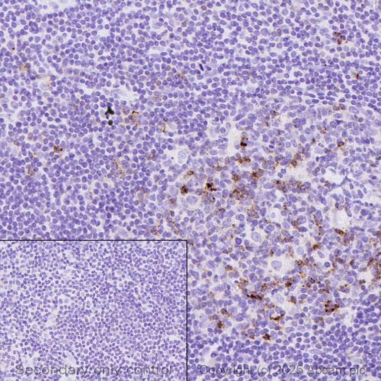 Immunohistochemistry (Formalin/PFA-fixed paraffin-embedded sections) - Anti-ICOS antibody [SP98] - BSA and Azide free (AB236226)