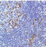 Immunohistochemistry (Formalin/PFA-fixed paraffin-embedded sections) - Anti-ICOS antibody [SP98] - BSA and Azide free (AB236226), expandable thumbnail