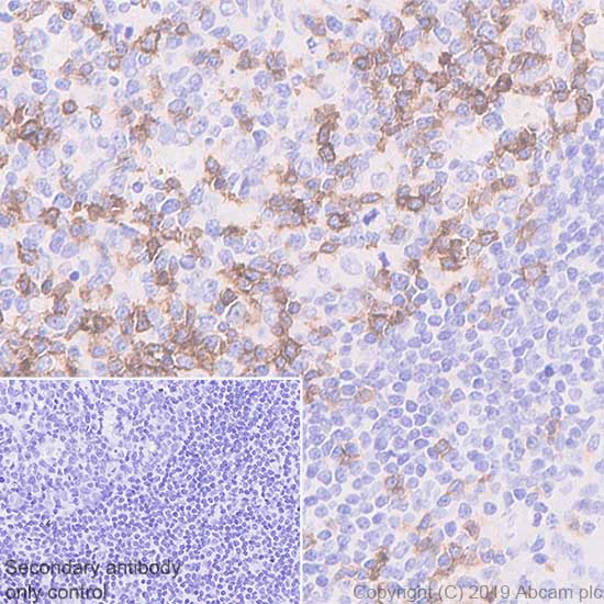 Immunohistochemistry (Formalin/PFA-fixed paraffin-embedded sections) - Anti-ICOS antibody [SP98] - BSA and Azide free (AB236226), expandable thumbnail