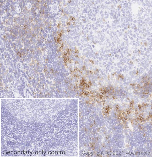 Immunohistochemistry (Frozen sections) - Anti-ICOS antibody [SP98] - BSA and Azide free (AB236226)