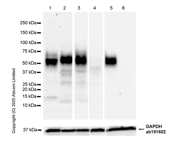 Western blot - Anti-ICOS Ligand/ICOSL antibody [EPR30369-585] (AB324345)
