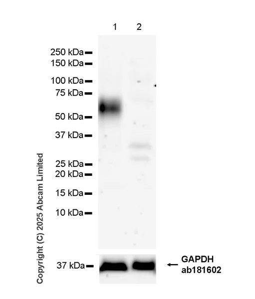 Western blot - Anti-ICOS Ligand/ICOSL antibody [EPR30369-585] (AB324345)