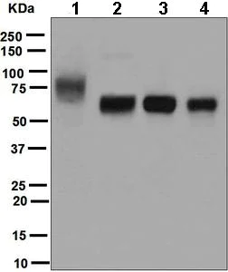 Western blot - Anti-ICOS Ligand/ICOSL antibody [EPR6071] (AB124972)