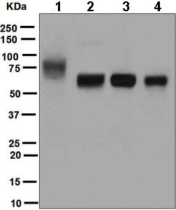 Western blot - Anti-ICOS Ligand/ICOSL antibody [EPR6071] - BSA and Azide free (AB248080), expandable thumbnail